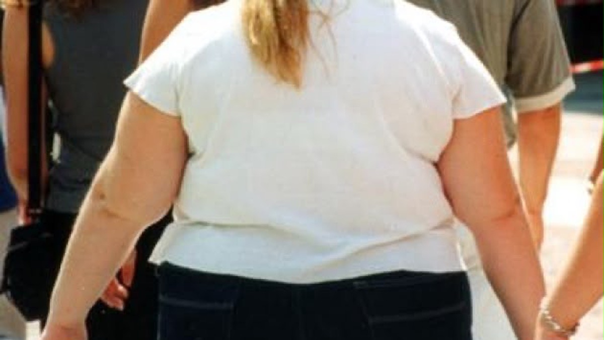 Obesità in adolescenza, cambiano le cure: è una malattia cronica